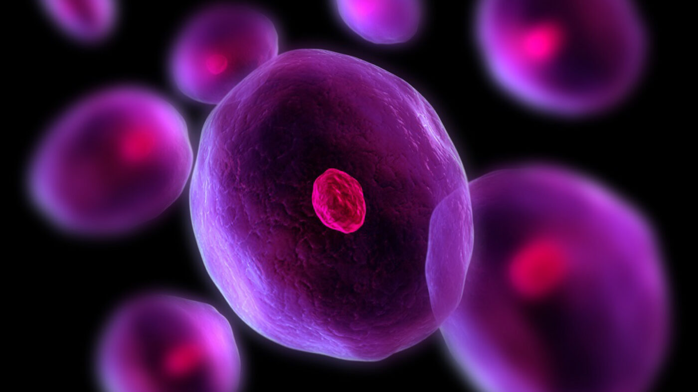 Startup | ChemiCare | malattie rare correlate al calcio